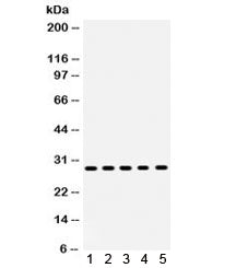 Western blot testing of human 1) MCF7, 2) MM231, 3) MM453, 4) SKOV and 5) HeLa lysate with XBP1 antibody. Expected/observed molecular weight ~29/40 kDa (isoform 1/2).