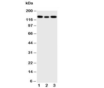 Western blot testing of IGF1R antibody and Lane 1: 293T; 2: A549; 3: MCF-7 cell lysate. Predicted molecular weight: ~200 kDa (pro), 120-130 kDa (alpha), 90-97 kDa (beta).