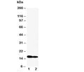 Western blot testing of IFITM1 antibody and Lane 1: SW620; 2: CEM cell lysate