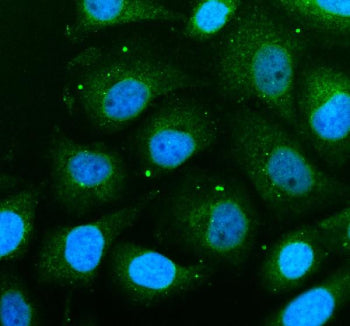 Immunofluorescent staining of THEM6 using anti-THEM6 antibody (green). THEM6 was detected in an immunocytochemical section of SIHA cells. Enzyme antigen retrieval was performed using IHC enzyme antigen retrieval reagent for 15 mins. The cells were blocked with 10% goat serum. And then incubated with 5 ug/ml rabbit anti-THEM6 antibody overnight at 4oC. DyLight 488 Conjugated Goat Anti-Rabbit IgG was used as secondary antibody at 1:500 dilution and incubated for 30 min at 37oC.