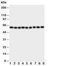 Western blot testing of IL5RA antibody and Lane 1: A549; 2: SMMC-7721; 3: U87; 4: 293T; 5: PANC; 6: HeLa; 7: Jurkat; 8: Raji; 9: CEM cell lysate. The 420 amino acid protein is routinely visualized between 46~60KD, depending on level of glycosylation.