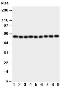 Western blot testing of IL5RA antibody and Lane 1: A549; 2: SMMC-7721; 3: U87; 4: 293T; 5: PANC; 6: HeLa; 7: Jurkat; 8: Raji; 9: CEM cell lysate. The 420 amino acid protein is routinely visualized between 46~60KD, depending on level of glycosylation.