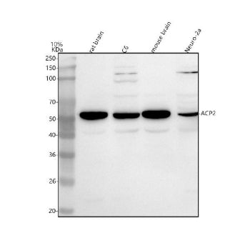 Western blot analysis of ACP2 using anti-ACP2 antibody. Lane 1: human Hela whole cell lysates, Lane 2: human U251 whole cell lysates, Lane 3: human MCF-7 whole cell lysates, Lane 4: human Caco-2 whole cell lysates, Lane 5: human 293T whole cell lysates, Lane 6: human whole cell lysates, Lane 7: human SH-SY5Y whole cell lysates. After electrophoresis, proteins were transferred to a nitrocellulose membrane at 150 mA for 50-90 min. Blocked the membrane with 5% non-fat milk/TBS for 1.5 hour at RT.