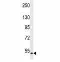 Western blot analysis of ZAK antibody and human HepG2 lysate. There are three isoforms of ZAK, visualized at ~91 kDa, ~51 kDa and ~35 kDa.
