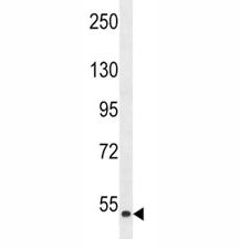 Western blot analysis of ZAK antibody and human HepG2 lysate. There are three isoforms of ZAK, visualized at ~91 kDa, ~51 kDa and ~35 kDa.