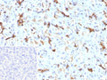 IHC staining of FFPE human pancreas tissue with recombinant CFTR antibody (clone CFTR/9148R). Inset: PBS used in place of primary Ab (secondary Ab negative control). HIER: boil tissue sections in pH 9 10mM Tris with 1mM EDTA for 20 min and allow to cool before testing.