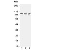 Western blot testing of ZO-3 antibody and Lane 1: PANC; 2: A549; 3: HeLa cell lysate. Predicted/observed size ~103KD
