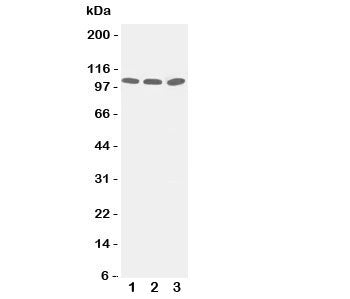 Western blot testing of ZO-3 antibody and Lane 1: PANC; 2: A549; 3: HeLa cell lysate. Predicted/observed size ~103KD