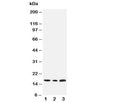 Western blot testing of SDHC antibody and Lane 1: rat liver; 2: HeLa; 3: Jurkat cell lysate