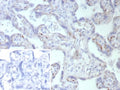 IHC staining of FFPE human placental tissue with Fatty Acid Binding Protein 4 antibody (clone FABP4/9086R). Inset: PBS used in place of primary Ab (secondary Ab negative control). HIER: boil tissue sections in pH 9 10mM Tris with 1mM EDTA for 20 min and allow to cool before testing.