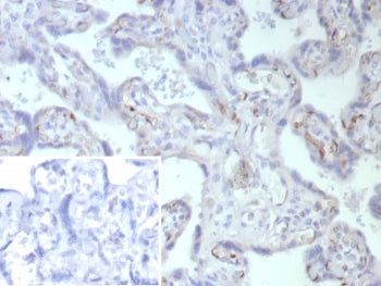 IHC staining of FFPE human placental tissue with Fatty Acid Binding Protein 4 antibody (clone FABP4/9086R). Inset: PBS used in place of primary Ab (secondary Ab negative control). HIER: boil tissue sections in pH 9 10mM Tris with 1mM EDTA for 20 min and allow to cool before testing.