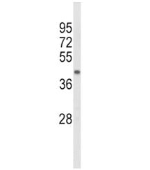 Western blot analysis of ACADL antibody and mouse kidney tissue lysate. Predicted molecular weight ~48 kDa.