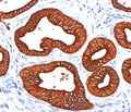 IHC staining of FFPE human skin tissue stained with Cytokeratin 18 antibody (clone DC10).