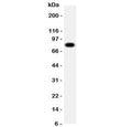 Western blot testing of ADAM2 antibody in human SMMC-7721 cell lysate. Predicted molecular weight ~82 kDa, but can be observed at ~100 kDa.