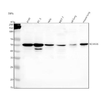 Western blot analysis of SCARA5 using anti-SCARA5 antibody. Lane 1: human whole cell lysates, Lane 2: human PC-3 whole cell lysates, Lane 3: human Hela whole cell lysates, Lane 4: human MCF-7 whole cell lysates, Lane 5: rat lung tissue lysates, Lane 6: mouse lung tissue lysates. After electrophoresis, proteins were transferred to a nitrocellulose membrane at 150 mA for 50-90 min. Blocked the membrane with 5% non-fat milk/TBS for 1.5 hour at RT.