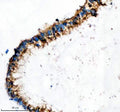 Immunohistochemical staining of IFT20 using anti-IFT20 antibody. IFT20 was detected in a paraffin-embedded section of human testis cancer tissue. Heat mediated antigen retrieval was performed in EDTA buffer (pH 8.0, epitope retrieval solution). The tissue section was blocked with 10% goat serum. The tissue section was then incubated with 2 ug/ml rabbit anti-IFT20 antibody overnight at 4oC. Peroxidase Conjugated Goat Anti-rabbit IgG was used as secondary antibody and incubated for 30 min at 37oC.
