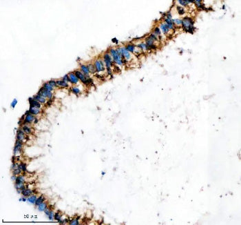 Immunohistochemical staining of IFT20 using anti-IFT20 antibody. IFT20 was detected in a paraffin-embedded section of human testis cancer tissue. Heat mediated antigen retrieval was performed in EDTA buffer (pH 8.0, epitope retrieval solution). The tissue section was blocked with 10% goat serum. The tissue section was then incubated with 2 ug/ml rabbit anti-IFT20 antibody overnight at 4oC. Peroxidase Conjugated Goat Anti-rabbit IgG was used as secondary antibody and incubated for 30 min at 37oC.