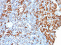 IHC testing of FFPE human lymph node with recombinant IBA1 antibody (clone rAIF1/1909). HIER: boil tissue sections in pH6, 10mM citrate buffer, for 10-20 min followed by cooling at RT for 20 min.