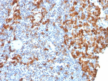 IHC testing of FFPE human lymph node with recombinant IBA1 antibody (clone rAIF1/1909). HIER: boil tissue sections in pH6, 10mM citrate buffer, for 10-20 min followed by cooling at RT for 20 min.