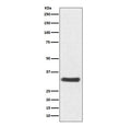 Western blot testing of human SH-SY5Y cell lysate with NQO1 antibody. Predicted molecular weight ~30 kDa.