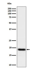 Western blot analysis of TNFAIP8 expression in human A549 cell lysate using TNFAIP8 antibody. TNFAIP8 western blot shows a predominant band at ~19 kDa. Although the predicted mass is ~23 kDa, TNFAIP8 commonly migrates at ~18-21 kDa due to electrophoretic mobility characteristics of small acidic proteins and possible isoform/alternative-start usage.