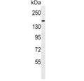 Western blot testing of human MDA-MB-435 cell lysate with Protocadherin 9 antibody. Expected molecular weight: 136-180 kDa.