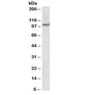 Western blot testing of human heart lysate with USP4 antibody at 1ug/ml. Predicted molecular weight: 104kDa.