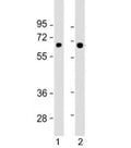 Western blot testing of human 1) SK-BR-3 and 2) TT cell lysate with SLC5A8 antibody at 1:1000. Predicted molecular weight: 67 kDa.
