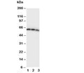 Western blot testing of CD40 antibody and Lane 1: Recombinant human protein 10ng; 2: 5ng; 3: 2.5ng