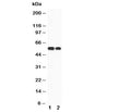 Western blot testing of CaMKK antibody and Lane 1: rat brain; 2: mouse brain