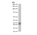 Western blot testing of human Jurkat cells with CD3e antibody (clone CDLA3e-1). Expected molecular weight ~23 kDa.