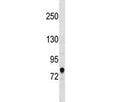 Western blot testing of human HepG2 cell lysate with ACSL3 antibody at 0.5ug/ml. Predicted molecular weight ~80 kDa.