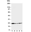 Western blot testing of Caveolin-1 antibody and Lane 1: U87; 2: HeLa; 3: MCF-7; 4: A549; 5: HT1080 cell lysate. Predicted molecular weight ~21/17kDa (alpha/beta isoforms)