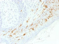 IHC testing of FFPE human skin with recombinant CD1a antibody (clone C1A/1506R). Required HIER: boil tissue sections in 10mM Citrate buffer, pH 6, for 10-20 min.