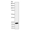Western blot testing of human HEK293 cell lysate with NDUFB9 antibody. Predicted molecular weight ~22 kDa.