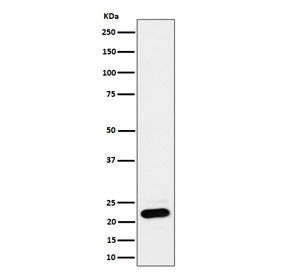 Western blot testing of human HEK293 cell lysate with NDUFB9 antibody. Predicted molecular weight ~22 kDa.
