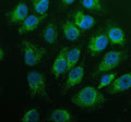 Immunofluorescent staining of GK2 using anti-GK2 antibody (green). GK2 was detected in an immunocytochemical section of cells. Enzyme antigen retrieval was performed using IHC enzyme antigen retrieval reagent for 15 mins. The cells were blocked with 10% goat serum. And then incubated with 5 ug/ml rabbit anti-GK2 antibody overnight at 4oC. DyLight 488 Conjugated Goat Anti-Rabbit IgG was used as secondary antibody at 1:500 dilution and incubated for 30 min at 37oC.