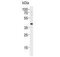 Western blot testing of human HUVEC with TBX1 antibody. Predicted molecular weight ~43 kD.