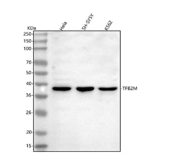 Western blot analysis of TFB2M using anti-TFB2M antibody. Lane 1: human Hela whole cell lysates, Lane 2: human SH-SY5Y whole cell lysates, Lane 3: human K562 whole cell lysates. After electrophoresis, proteins were transferred to a nitrocellulose membrane at 150 mA for 50-90 min. Blocked the membrane with 5% non-fat milk/TBS for 1.5 hour at RT.