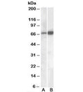Western blot testing of human cerebellum lysate with CADM4 antibody A) cat # R34370 (0.1ug/ml) and B) cat # <a href=../tds/cadm4-antibody-r35577>R35577</a> (0.05ug/ml). Predicted molecular weight: ~43/50-70kDa (unmodified/glycosylated)