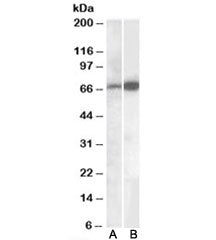 Western blot testing of human cerebellum lysate with CADM4 antibody A) cat # R34370 (0.1ug/ml) and B) cat # <a href=../tds/cadm4-antibody-r35577>R35577</a> (0.05ug/ml). Predicted molecular weight: ~43/50-70kDa (unmodified/glycosylated)