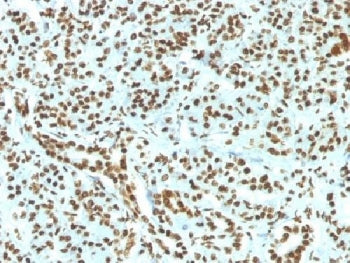 IHC testing of FFPE human pancreas and recombinant Histone H1 antibody (clone HH1/1784R). Required HIER: boil tissue sections in pH 9 10mM Tris with 1mM EDTA for 10-20 min.