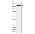 Western blot analysis of Phospho-AS160 (T642) expression in lysate from human 293T cells treated with insulin, using Phospho-AS160 (Thr642) antibody. Predicted molecular weight ~147 kDa, commonly observed at ~160 kDa.