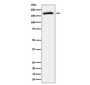 Western blot analysis of Phospho-AS160 (T642) expression in lysate from human 293T cells treated with insulin, using Phospho-AS160 (Thr642) antibody. Predicted molecular weight ~147 kDa, commonly observed at ~160 kDa.
