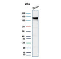 Western blot testing of human brain tissue lysate with Hexokinase 1 antibody (clone HK1/9517). Predicted molecular weight ~120 kDa.