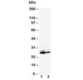 Western blot testing of C Reactive protein antibody and Lane 1: SMMC-7721; 2: HT1080 cell lysate. Predicted molecular weight ~26 kDa.