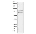 Western blot testing of human Jurkat cell lysate with ADAM10 antibody. Predicted molecular weight: ~84 kDa (full length), ~60 kDa (active form), ~80 kDa (glycosylated active form), ~110 kDa (glycosylated full length).