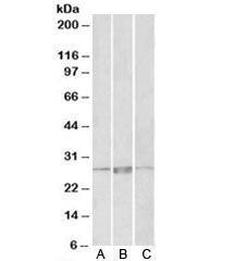 Western blot testing of human heart lysate with PRRX1 antibody at 1ug/ml. Predicted molecular weight: ~27kDa.