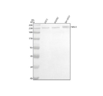 Western blot analysis of NAV3 using anti-NAV3 antibody. Lane 1: human U251 whole cell lysates, Lane 2: human HUVEC whole cell lysates, Lane 3: human SH-SY5Y whole cell lysates. After electrophoresis, proteins were transferred to a nitrocellulose membrane at 150 mA for 50-90 min. Blocked the membrane with 5% non-fat milk/TBS for 1.5 hour at RT.