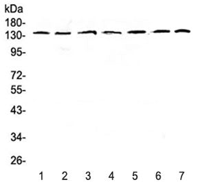 Western blot testing of human 1) HeLa, 2) COLO320, 3) A549, 4) SK-OV-3, 5) A431, 6) rat brain and 7) mouse brain lysate with PERK antibody at 0.5ug/ml. Predicted molecular weight ~125 kDa, observed here at ~140 kDa.